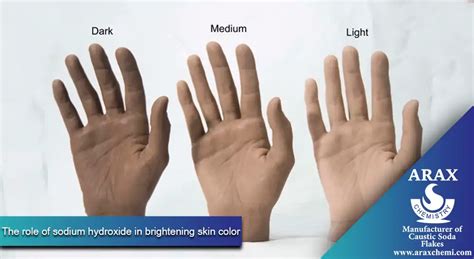 sodium hydroxide in shampoo|sodium hydroxide on skin.